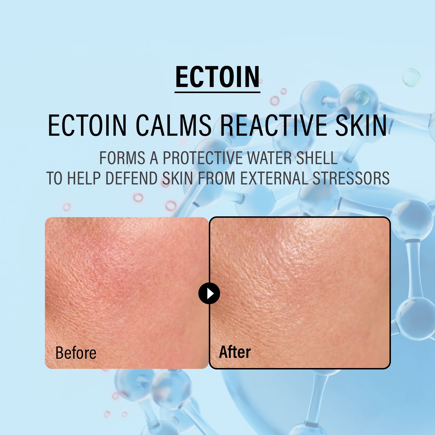 EPII Double Up Cream Ectoin & Panthenol 50ml