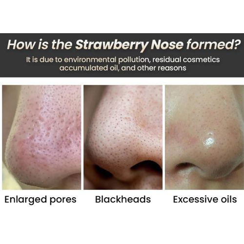 Purederm Nose Pore Strips Aloe 3Pcs