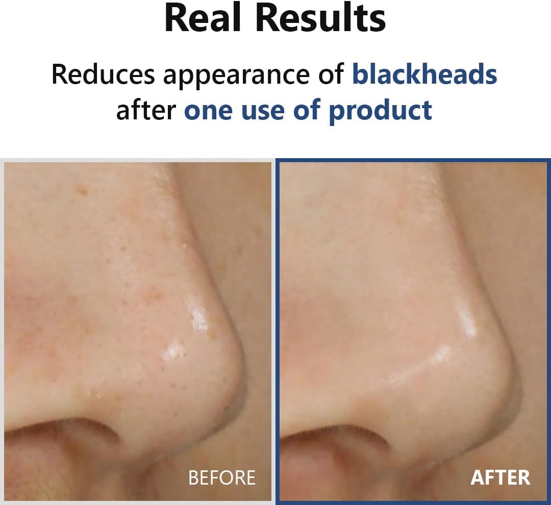 ISNTREE Hyper Acid4 Aha Bha Pha Lha 30 Serum 20ml