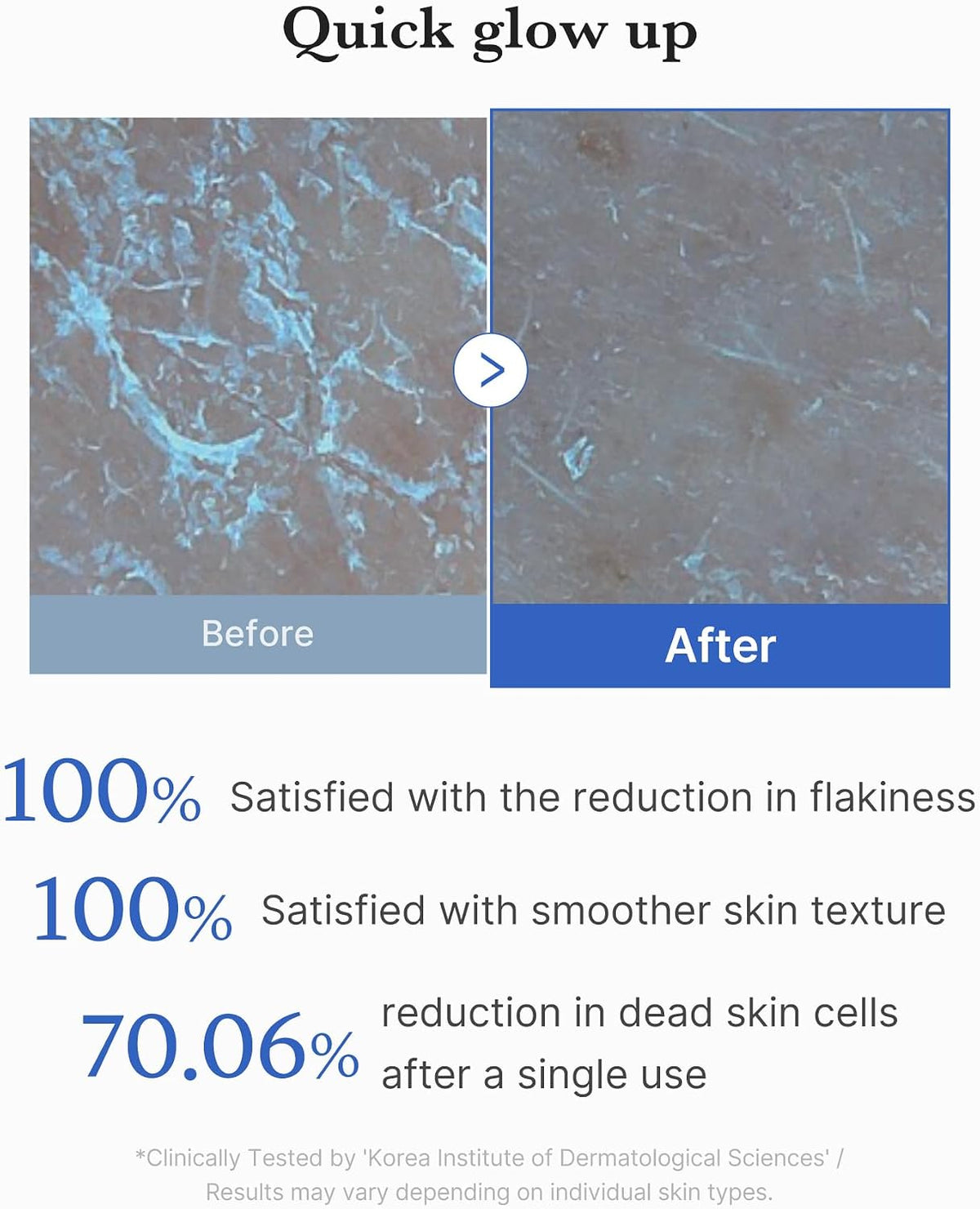 MEDICUBE ZERO PORE PEEL PAD (8EA)