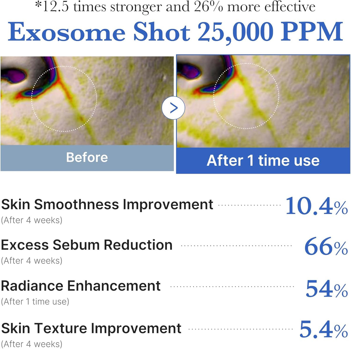 MEDICUBE One Day Exosome Shot Pore Ampoule 25000 13ml