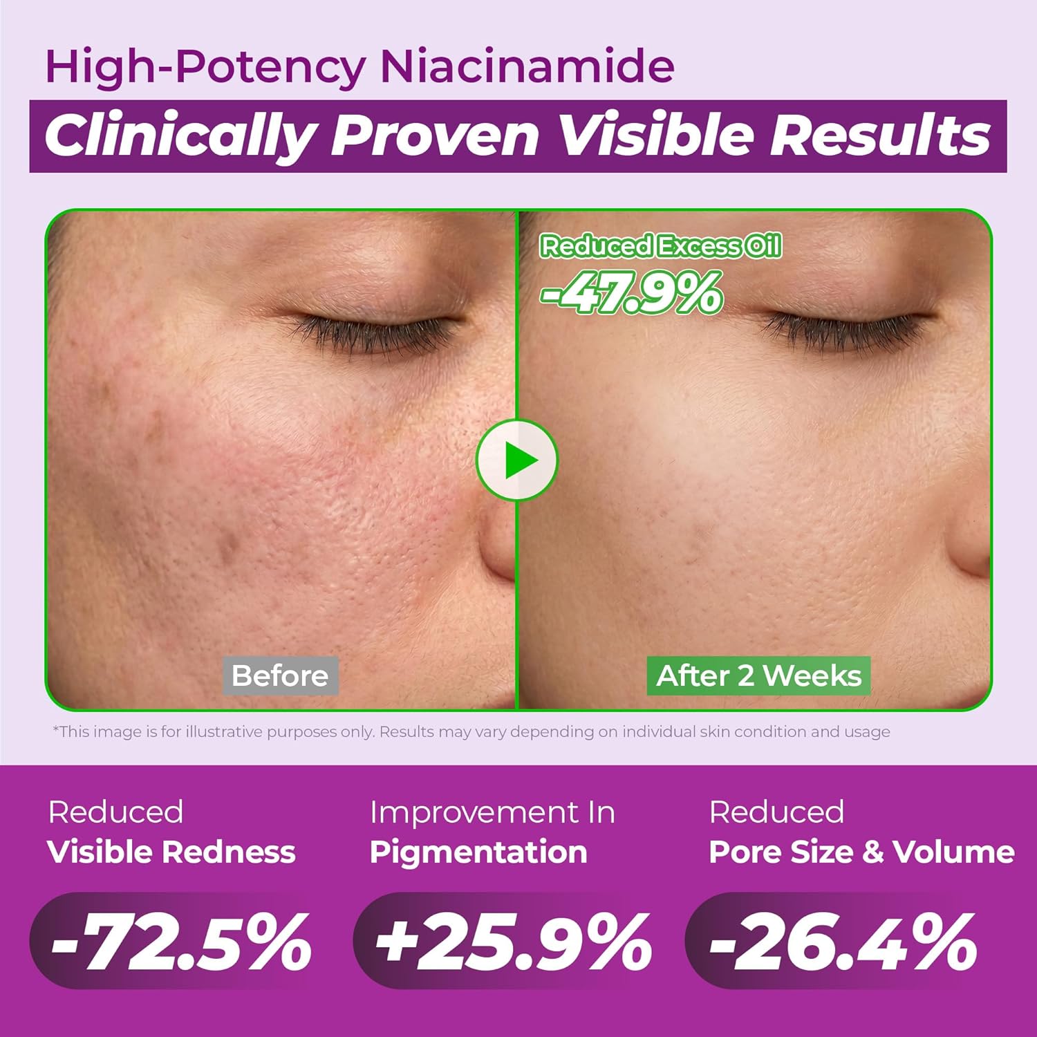 JUMISO 10% Niacinamide Serum 40ml