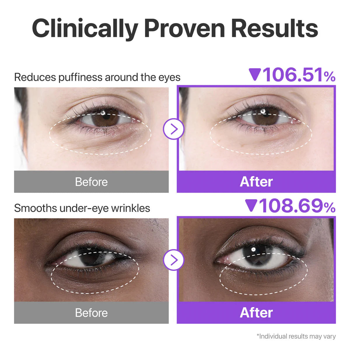Numbuzin NAD+ collagen under eye patches 2 patches