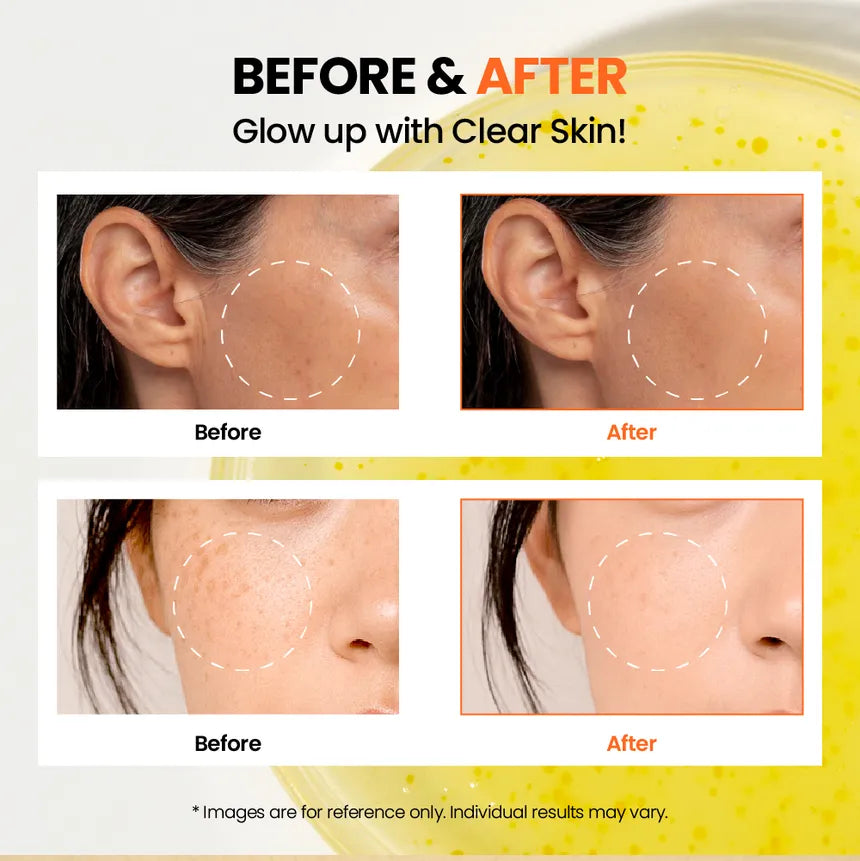 KSECRET SEOUL1988 Glow Serum: Niacinamide 15% + Yuja 30ml