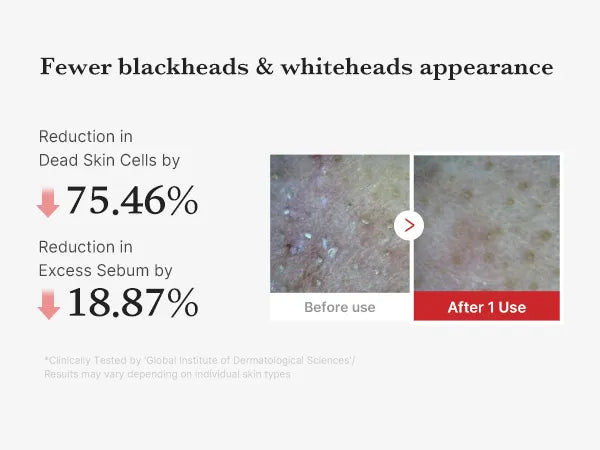 MEDICUBE Hypochlorous Acid Peel Shot 80ml