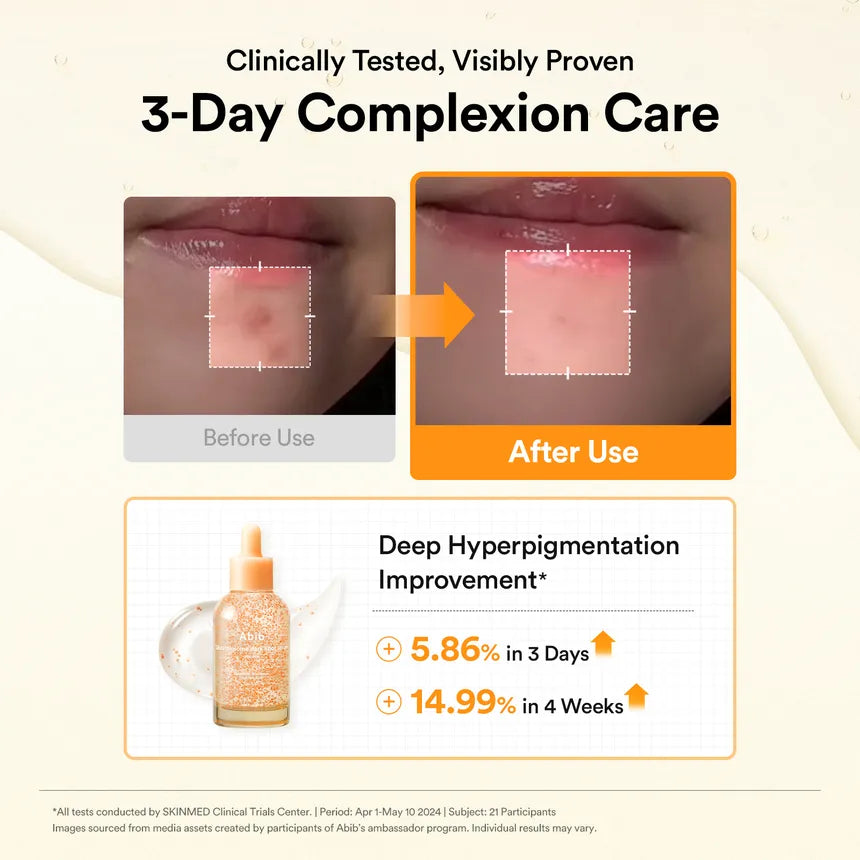 Abib Glutathiosome Dark Spot Serum Vita Drop 50ml