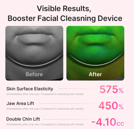 MEDICUBE AGE-R Booster Facial Cleansing Device Head